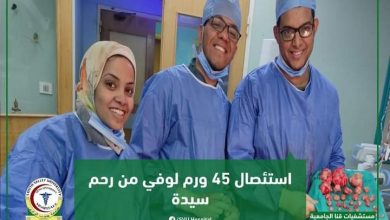 استئصال 45 روم لوفي من رحم سيدة بمستشفيات قنا الجامعية