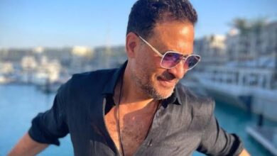 إصابة الفنان ماجد المصري بقطع ونزيف في شبكية العين