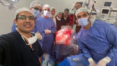  نجاح أطباء مستشفى طوارئ قصر العيني في إنقاذ مريض