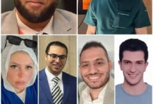 فريق طبي بجامعة أسيوط يعالج طفلة مصابة باستسقاء المخ