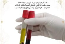 بلازما الحب ... كتبت / مها عبد العزيز